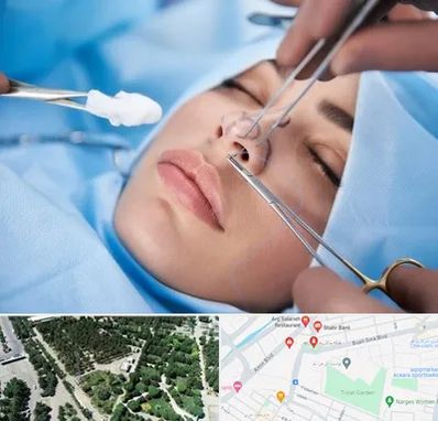 عمل ترمیمی بینی در سالاریه قم