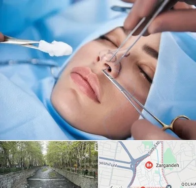 عمل ترمیمی بینی در زرگنده