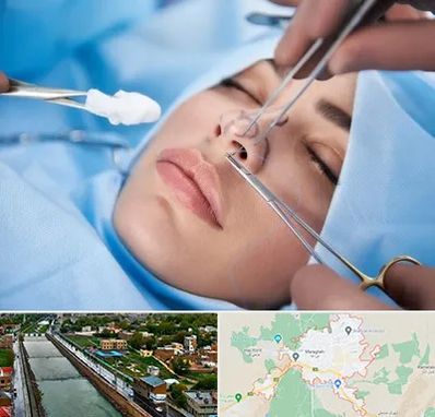 عمل ترمیمی بینی در مراغه