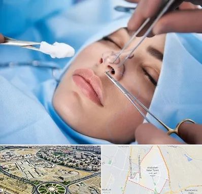 عمل ترمیمی بینی در اندیشه