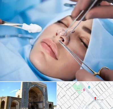 عمل ترمیمی بینی در مصلی مشهد