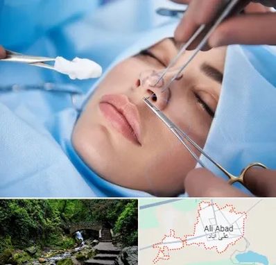 عمل ترمیمی بینی در علی آباد کتول