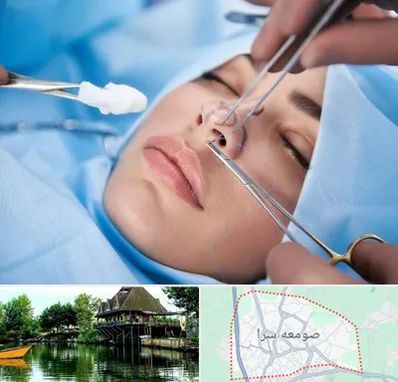 عمل ترمیمی بینی در صومعه سرا
