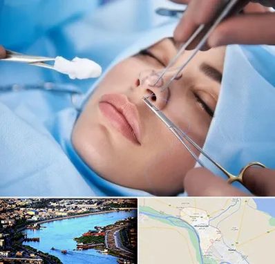 عمل ترمیمی بینی در خرمشهر