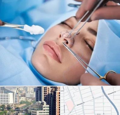 عمل ترمیمی بینی در خیابان بهشتی