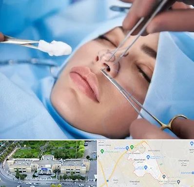 عمل ترمیمی بینی در نسیم شهر