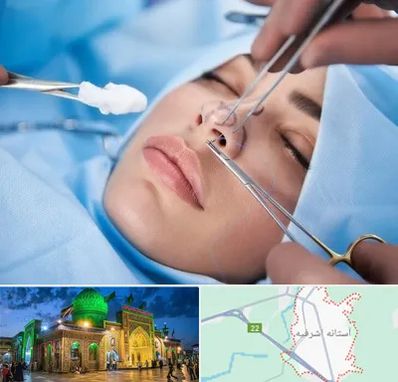 عمل ترمیمی بینی در آستانه اشرفیه