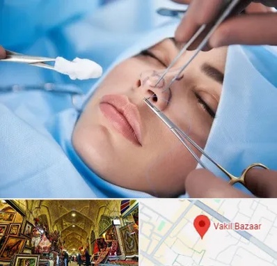 عمل ترمیمی بینی در بازار وکیل شیراز