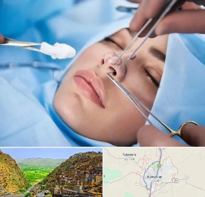 عمل ترمیمی بینی در کامیاران