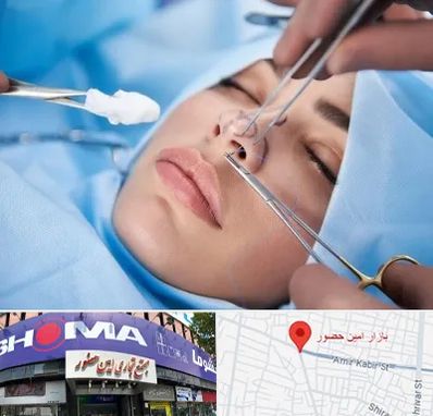 عمل ترمیمی بینی در امین حضور