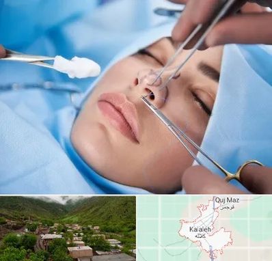 عمل ترمیمی بینی در کلاله