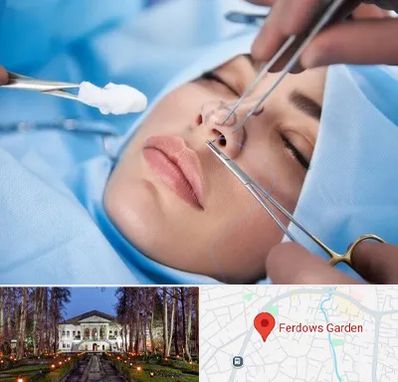 عمل ترمیمی بینی در باغ فردوس