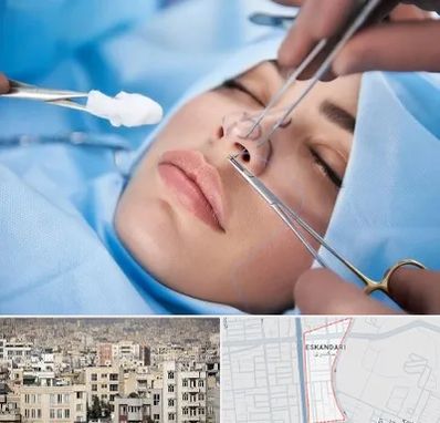 عمل ترمیمی بینی در اسکندری