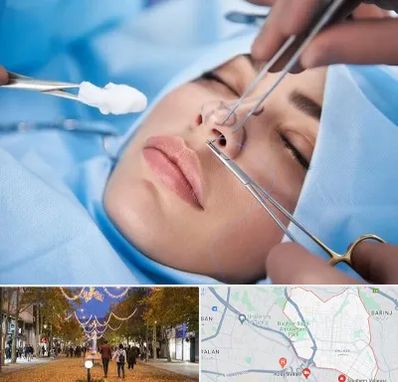 عمل ترمیمی بینی در ولیعصر ارومیه