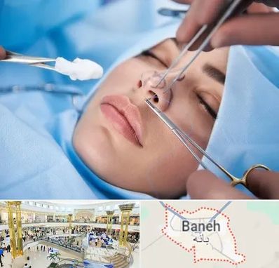 عمل ترمیمی بینی در بانه