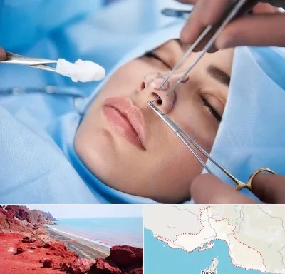 عمل ترمیمی بینی در هرمزگان