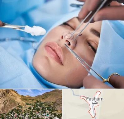 عمل ترمیمی بینی در فشم