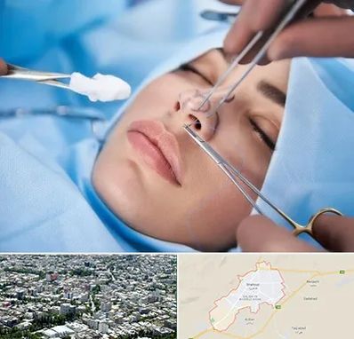عمل ترمیمی بینی در شاهرود