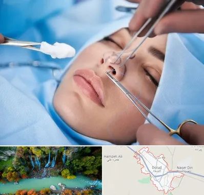 عمل ترمیمی بینی در دورود