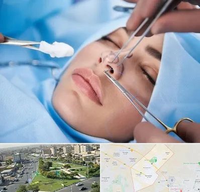عمل ترمیمی بینی در کمال شهر کرج