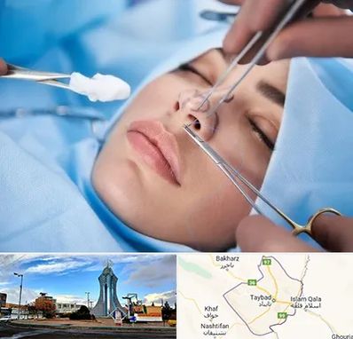 عمل ترمیمی بینی در تایباد
