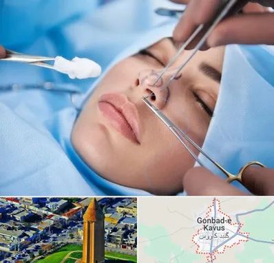 عمل ترمیمی بینی در گنبد کاووس