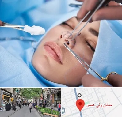 عمل ترمیمی بینی در ولیعصر شهریار