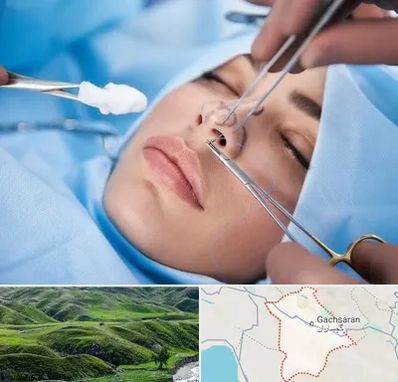 عمل ترمیمی بینی در گچساران