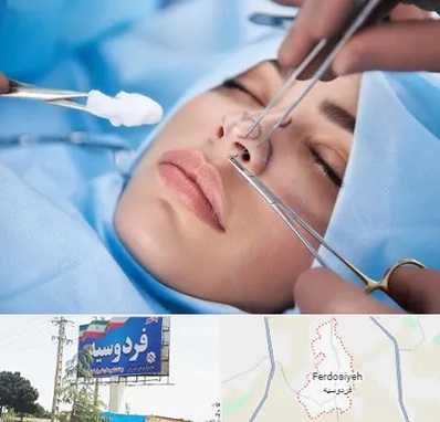 عمل ترمیمی بینی در فردوسیه شهریار