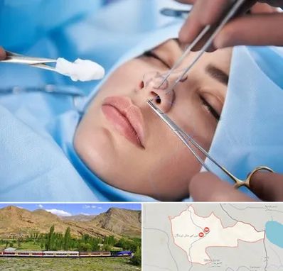 عمل ترمیمی بینی در خاش