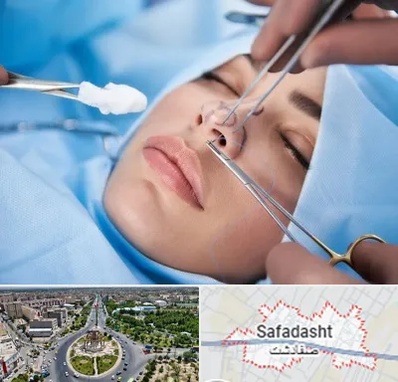 عمل ترمیمی بینی در صفادشت