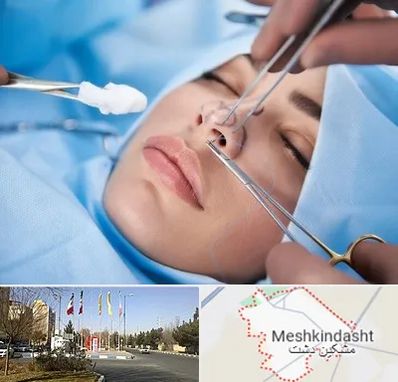 عمل ترمیمی بینی در مشکین دشت