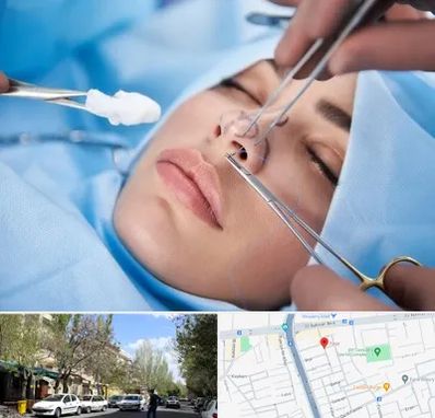 عمل ترمیمی بینی در کوی فیروز تبریز