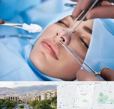 عمل ترمیمی بینی در خانی آباد
