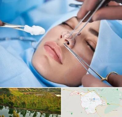 عمل ترمیمی بینی در بهبهان
