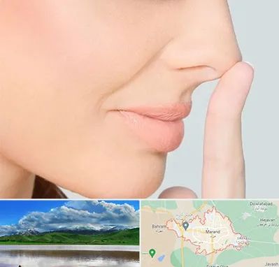 عمل تیپ پلاستی بینی در مرند