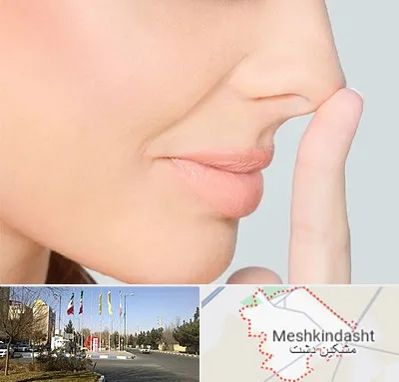عمل تیپ پلاستی بینی در مشکین دشت