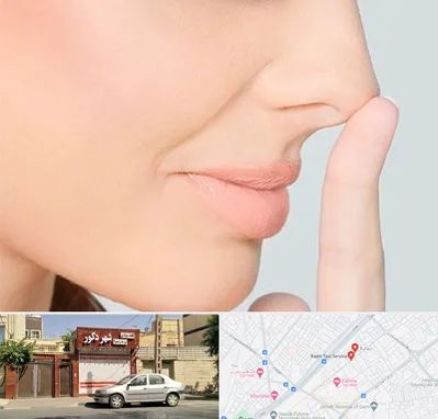 عمل تیپ پلاستی بینی در باجک قم