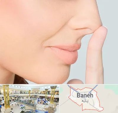 عمل تیپ پلاستی بینی در بانه