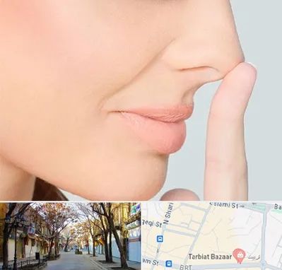 عمل تیپ پلاستی بینی در تربیت تبریز