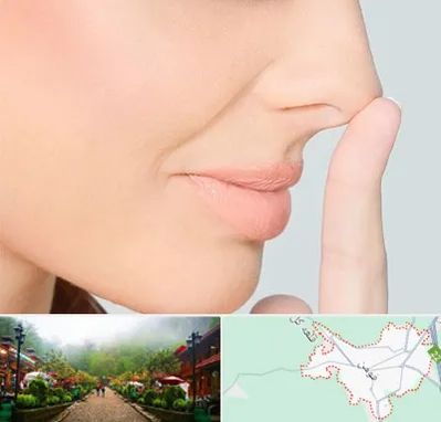 عمل تیپ پلاستی بینی در فومن