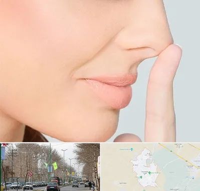 عمل تیپ پلاستی بینی در نظرآباد کرج