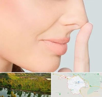 عمل تیپ پلاستی بینی در بهبهان