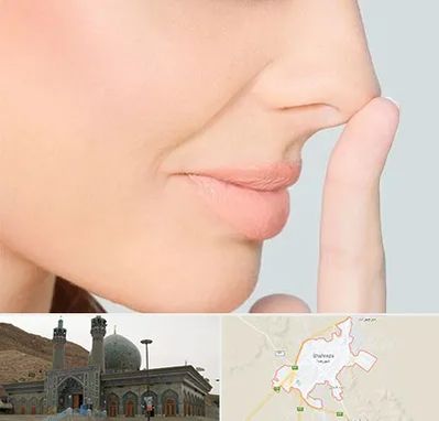 عمل تیپ پلاستی بینی در شهرضا