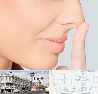 عمل تیپ پلاستی بینی در 17شهریور