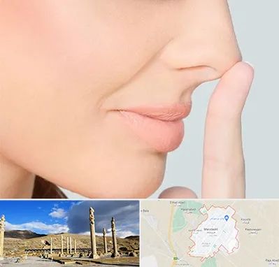 عمل تیپ پلاستی بینی در مرودشت