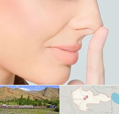 عمل تیپ پلاستی بینی در خاش