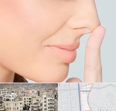 عمل تیپ پلاستی بینی در اسکندری