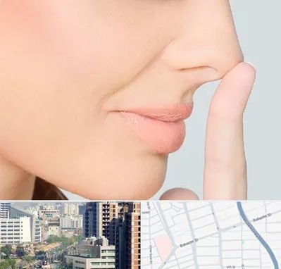 عمل تیپ پلاستی بینی در خیابان بهشتی