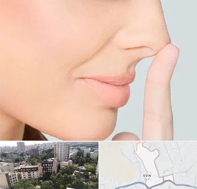 عمل تیپ پلاستی بینی در اوین